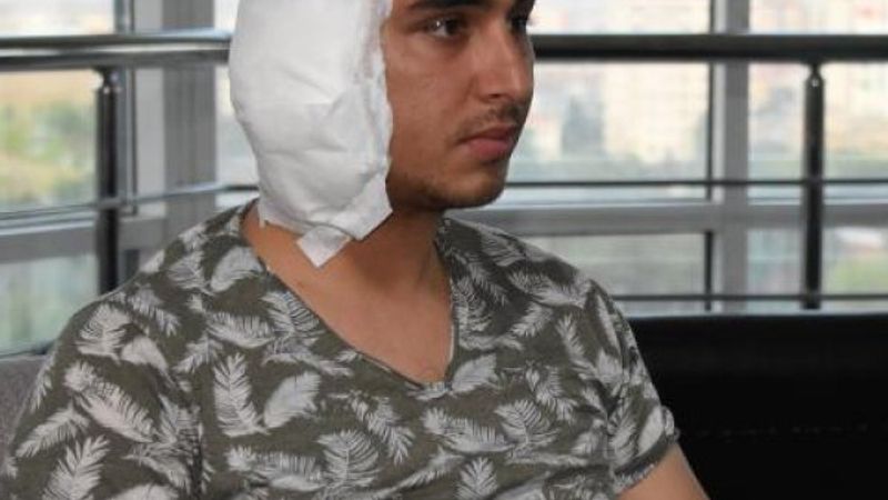 Köpek kavgasında postacının kulağı ısırıldı