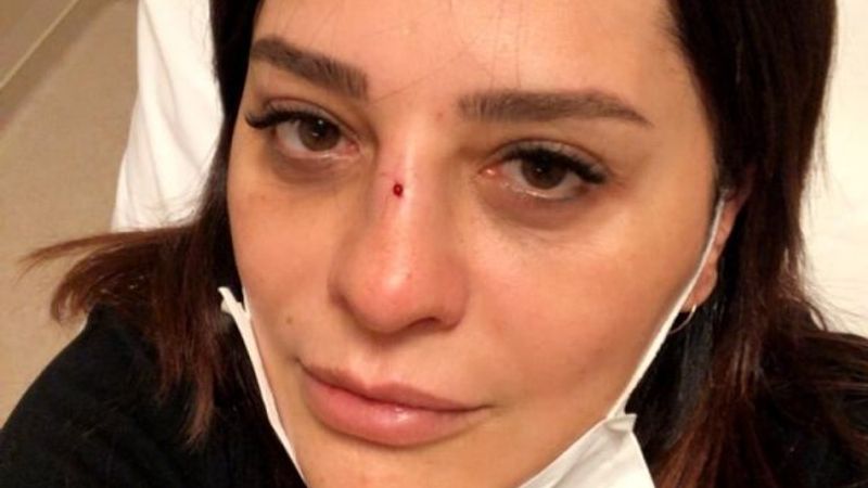 Reyhan Karaca bahçede düşüp, burnunu kırdı