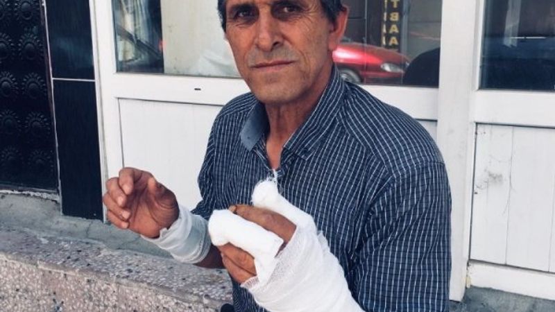 Yozgat’ta bir vatandaşa ayı saldırdı