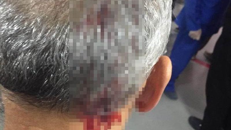 Elazığ'da sarhoş adam gittiği hastanede doktor darbetti