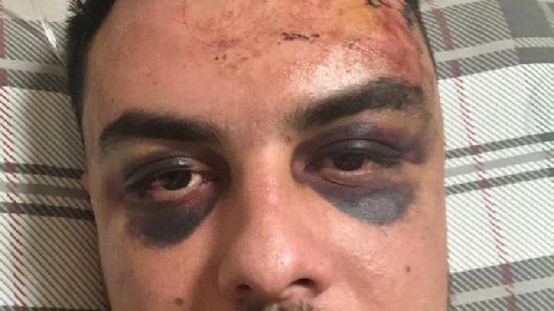 Mersin’de 4 kişinin dövdüğü genç komadan çıktı