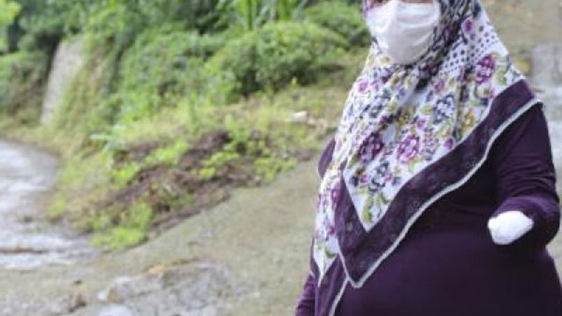 Trabzon'da 3 köpeğin saldırısına uğradı, kolunu kaybetti