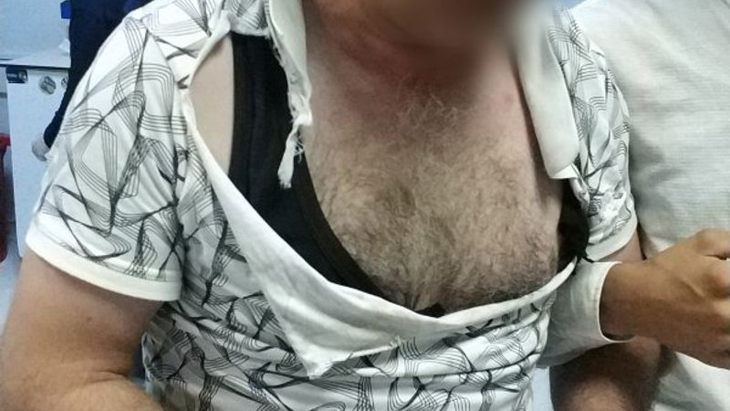 Samsun'da sebepsiz yere görme engelli vatandaşa saldırdı