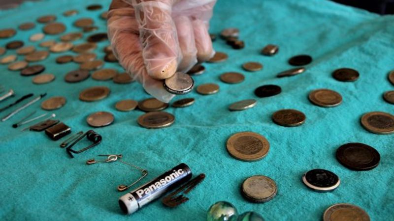 Çocukların midesinden onlarca yabancı cisim çıktı