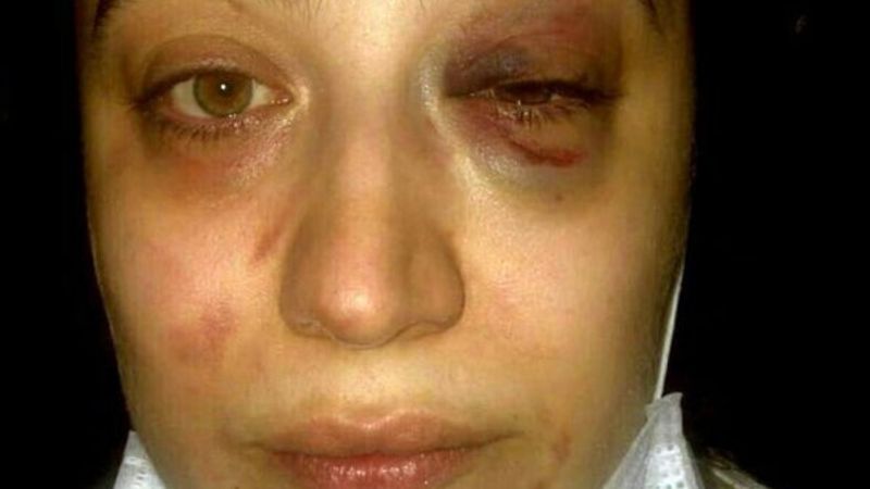 İstanbul'da eski eşinden şiddet gördü, yardım bekliyor