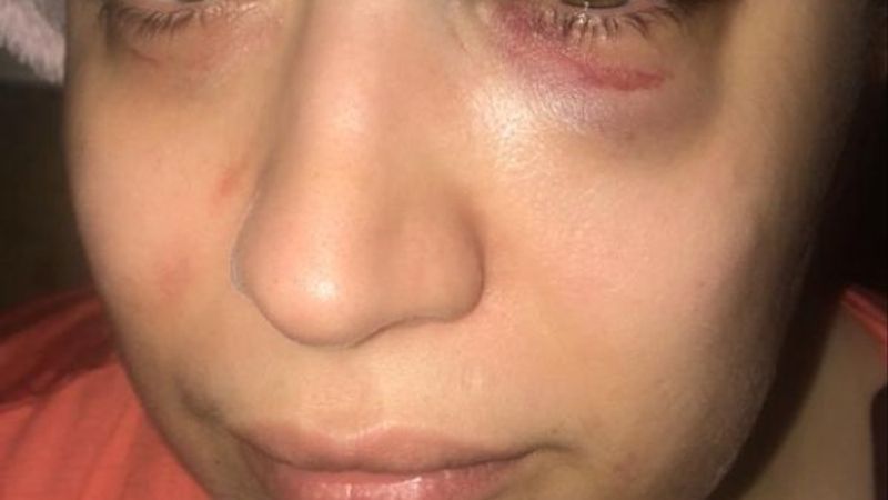 Bakırköy'de eski eşini darbeden firari yakayı ele verdi