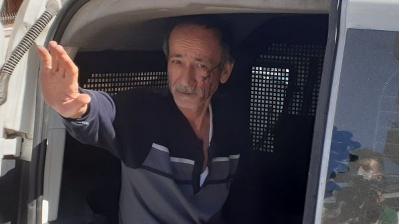 Ankara’da eşinin parmağını ısırarak kopardı