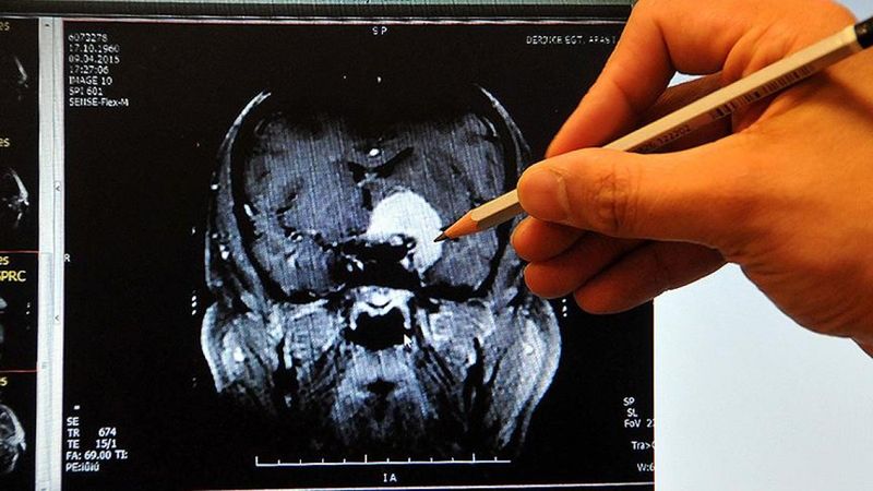 Damarlarımızdaki tehlike: Pıhtı atması