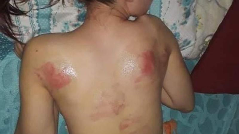 Tekirdağ’da cep telefonu şifresini söylemeyen kızını dövdü