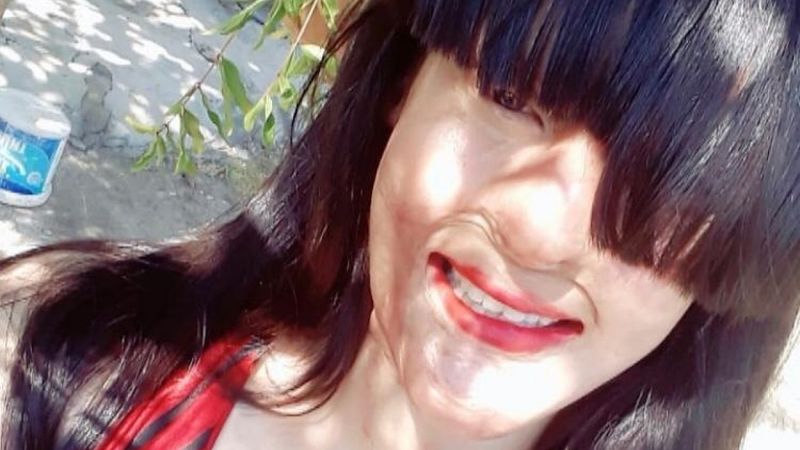 Saldırganını affeden Berfin Özek, 5 ay sonra pişman oldu