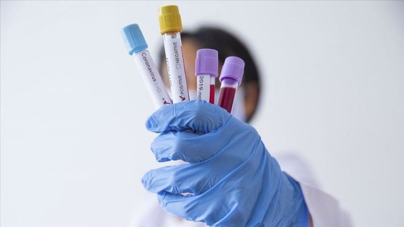 Koronavirüs, grip ve nezlede görülen farklı semptomlar