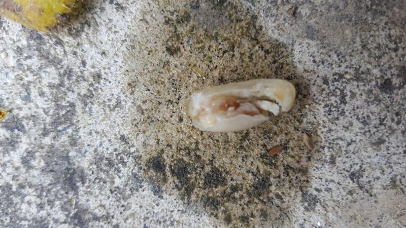 Tekirdağ'da yemeğinden kopmuş parmak çıktı