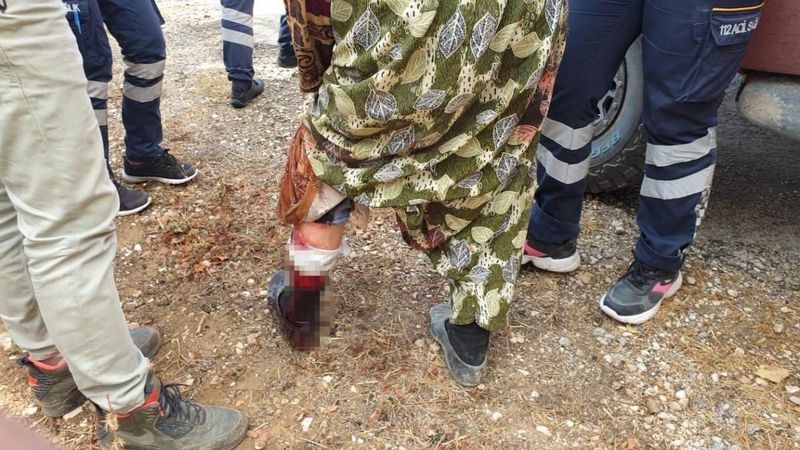 Bilecik'te domuz saldırısına uğrayan kadın hastaneye kaldırıldı