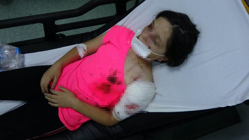 Samsun'da pitbull cinsi köpekler, 11 yaşındaki Tuğba'ya saldırdı