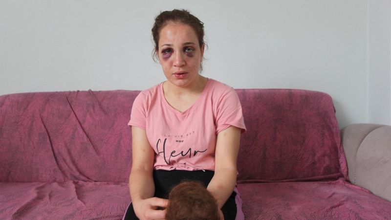 Aydın'da kocasından şiddet gören genç kadın yardım istiyor