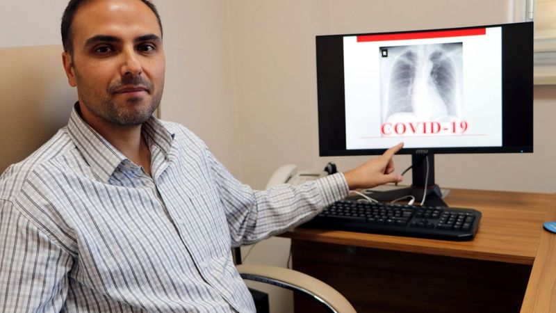 Van'da röntgen filmlerinden koronavirüsü teşhis eden sistem geliştirdi