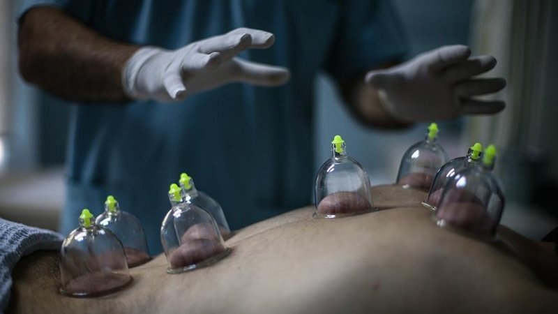 Hacamat nedir, nasıl yapılır? Hacamat hangi günler yapılır? Hacamatın faydaları nelerdir?