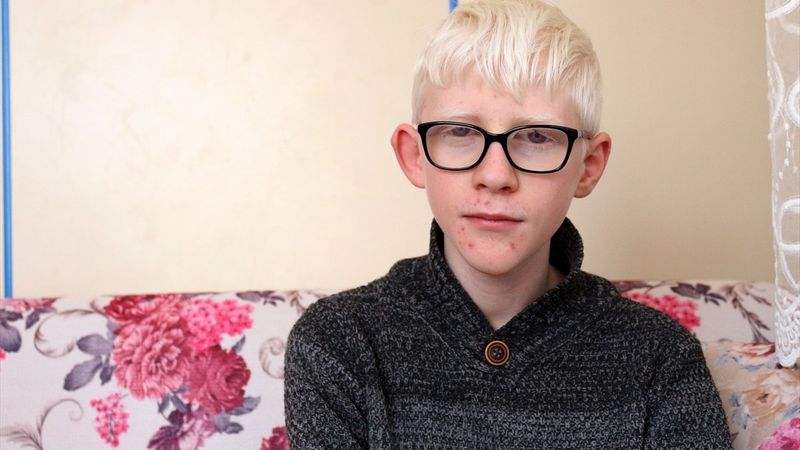 Konya'da Albinizm hastası Hüseyin Ali, azmiyle kendisi gibi çocuklara cesaret veriyor