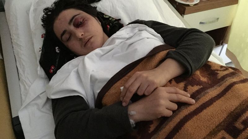 Samsun'da eşine şiddet uygulayan kocaya iyi hal indirimi