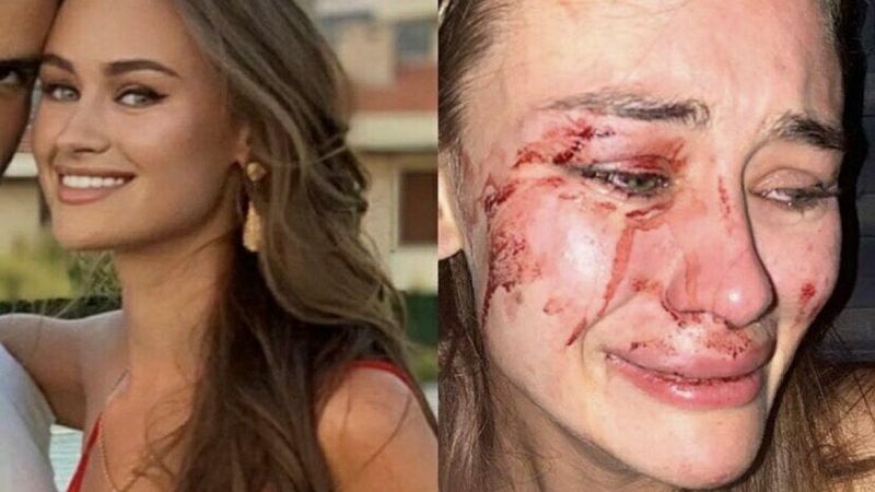 İzmir’de darbedilen Ukraynalı model, özrü kabul etti