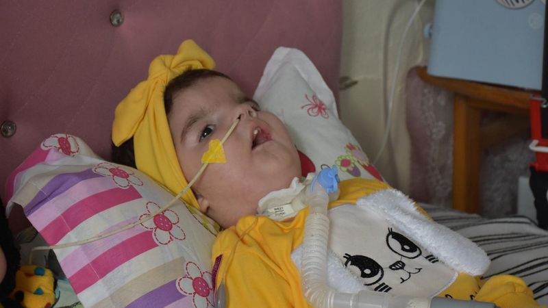 Tekirdağ'da SMA teşhisi konulan 17 aylık Yaren destek bekliyor