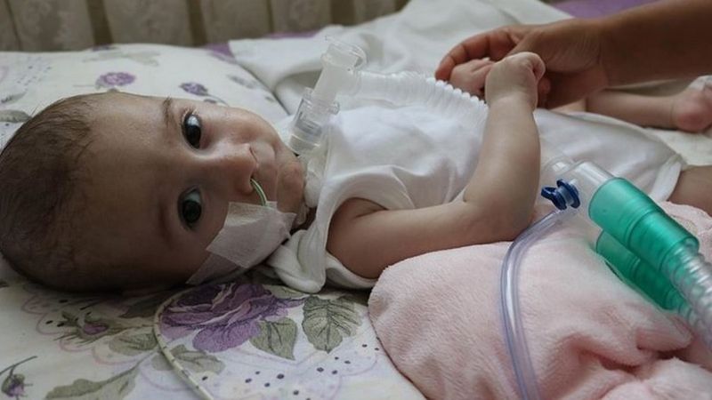 Almanya'da görevli Türk doktor: SMA hastaları için kampanya yapanlar, konuya hakim değil