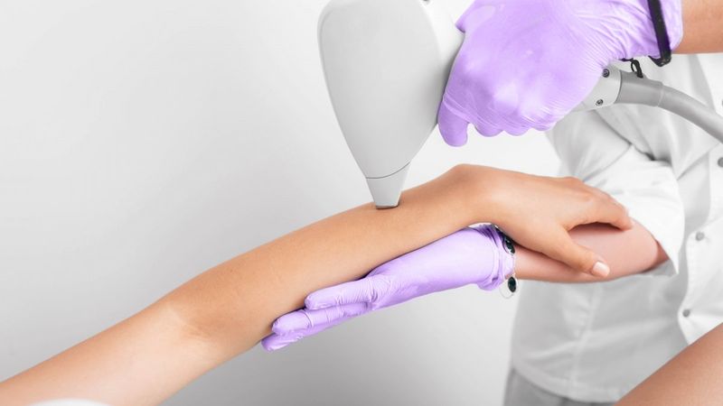 Buz Lazer İstenmeyen Tüylere Veda Etmenin En Kolay Yolu