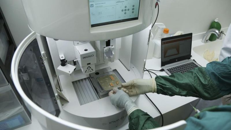 4D teknolojisi, dünyada ilk kez Türkiye'de yanık tedavisi için kullanılıyor.