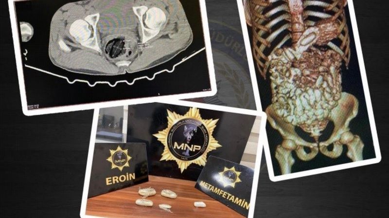 Muş'ta midelerinde uyuşturucu gizleyen 2 kişi yakalandı