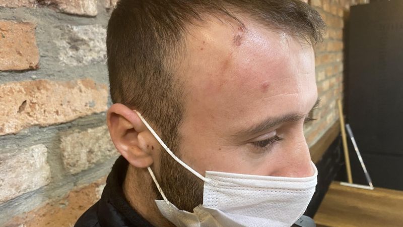 Çağlayan’da üzerine atlayan adamdan şikayetçi oldu