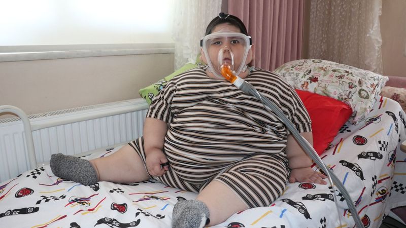 Samsun'da 5 yaşındaki çocuk 90 kiloya ulaştı