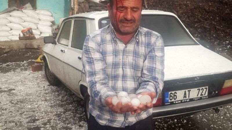 Yozgat'ta kafasına dolu düşen kişi hastanelik oldu