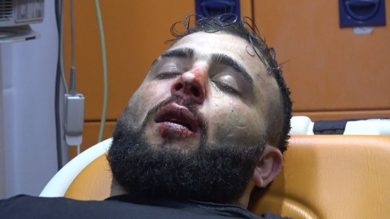 Bursa’da esnaf ile elemanına sokak ortasında dayak