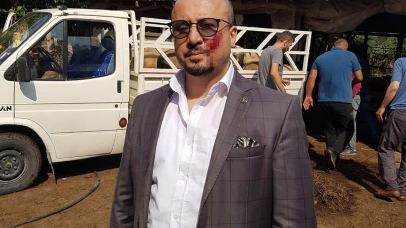 Bursa'da, avukatın yanağını ısıran kişiye ceza