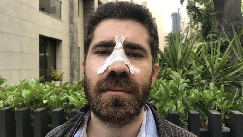 Kadıköy'de, aile hekimi sokak ortasında darbedildi