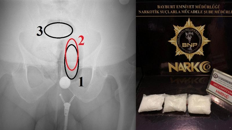 Bayburt’ta uyuşturucuyu anüs bölgesine sakladı