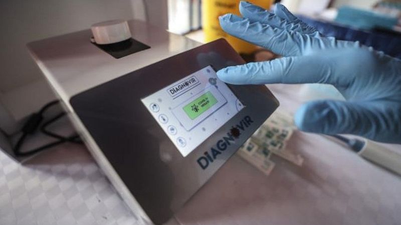 Diagnovir test nedir, nasıl çalışır? Yerli Diagnovir test ne kadar güvenilir?