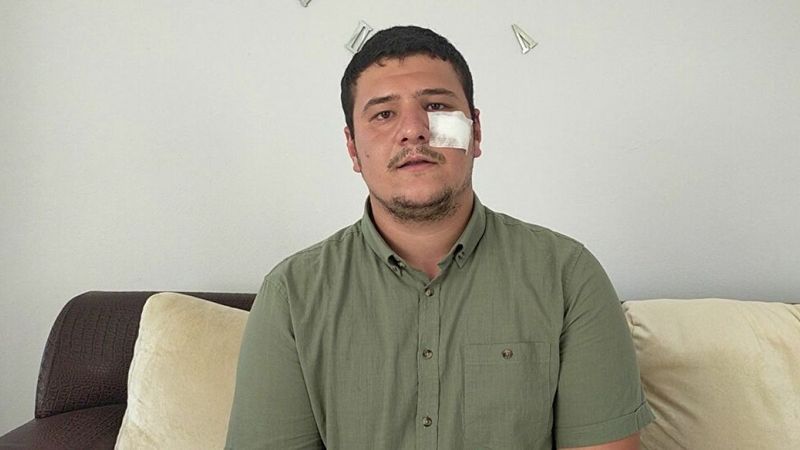 Saldırıya uğrayan İHA muhabiri, Meral Akşener’i yalanladı