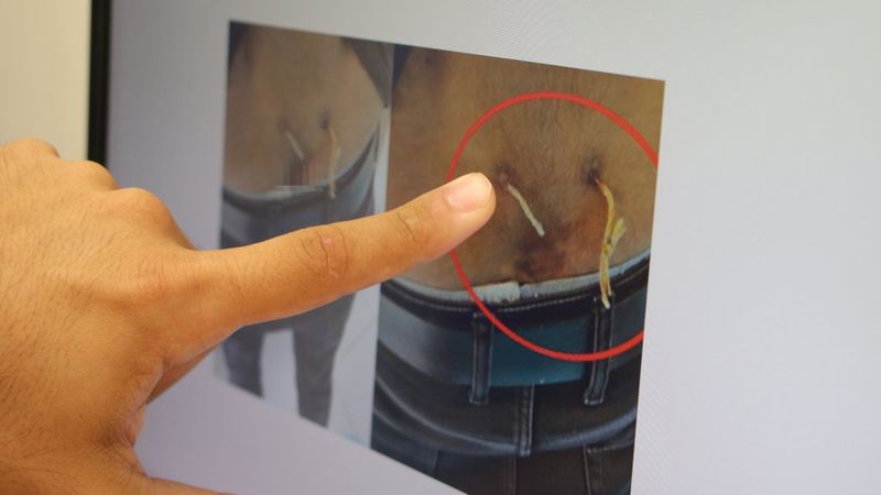 Elazığ'da ağrıları geçsin diye belinden çamaşır ipi geçirdiler