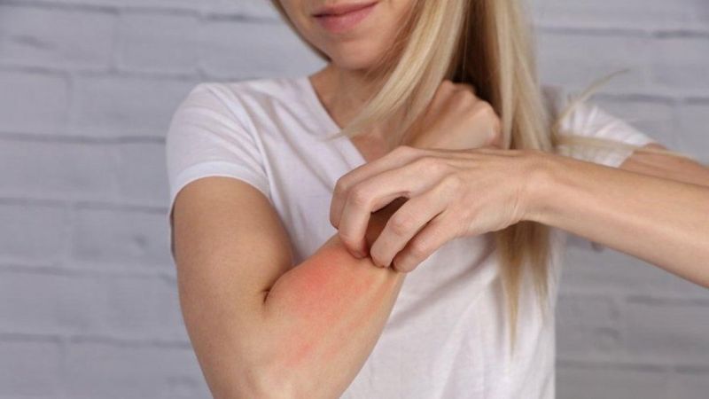 Anafilaksi nedir, belirtileri nelerdir? Anafilaksi hastaları aşı olabilir mi?