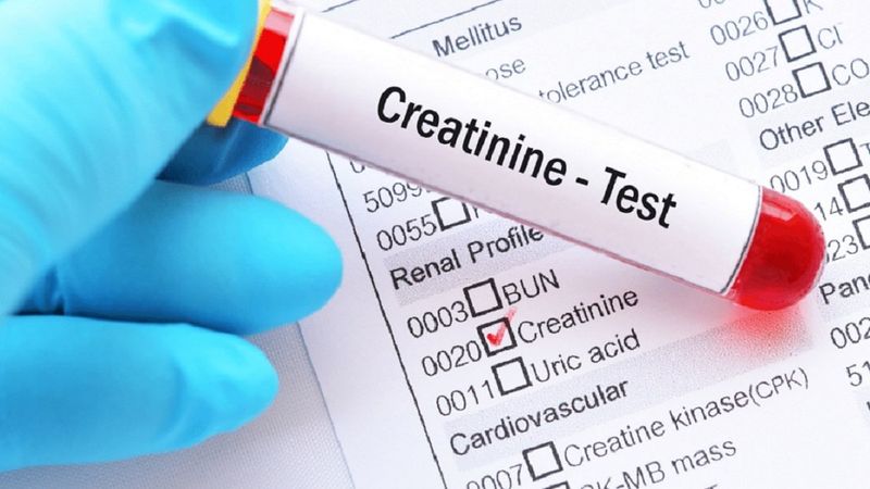 Kreatinin nedir