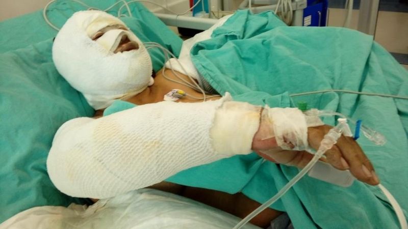 Mersin'de eski damadı tarafından benzinle yakıldı