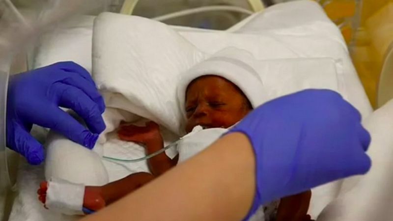 Fas'ta 9 bebek doğuran anne, çocuklarının bakımı ile ilgili konuştu