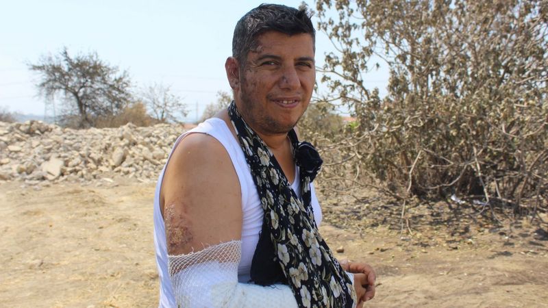 Manavgat'ta alevlerin arasından anne ve babasını kurtarmayı başardı