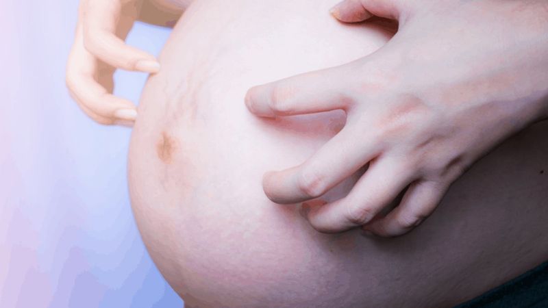 Hamile olanlar dikkat! Hamilelikte kaşıntı neden olur?