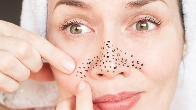 En inatçı sorun! Siyah noktalar nasıl temizlenir?
