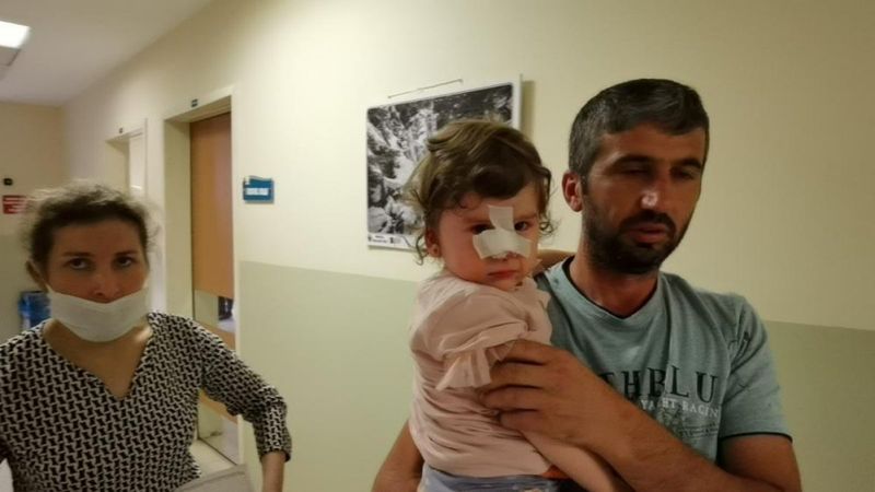 Bursa'da köpeğin saldırısına uğrayan 2 yaşındaki kızın burnu kırıldı