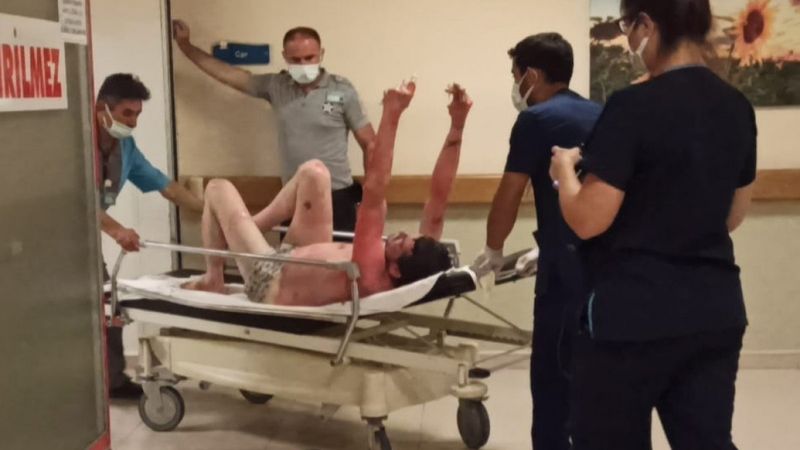 Bursa’da yangında yaralanan kişi hayatını kaybetti