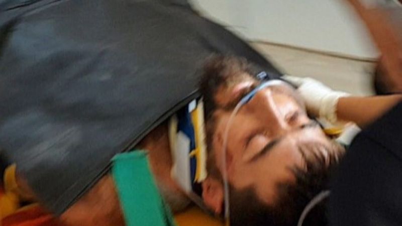 Kaz Dağları'nda çıkan yangına müdahale eden orman gönüllüsüne, ayı saldırdı