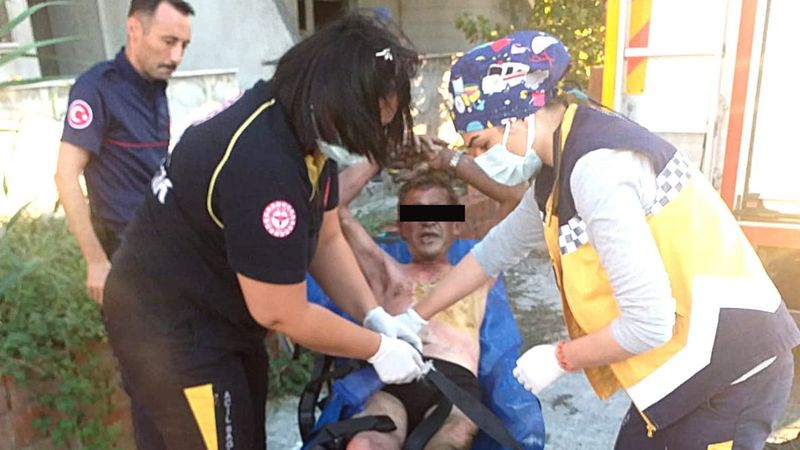 Balıkesir’de yangını söndürmeye çalışan kişi de yandı